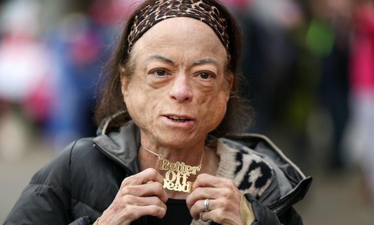 Liz Carr protests the assisted dying bill outside the Scottish parliament. (Jeff J Mitchell/Getty Images) Liz Carr protests the assisted dying bill outside the Scottish parliament. (Jeff J Mitchell/Getty Images)