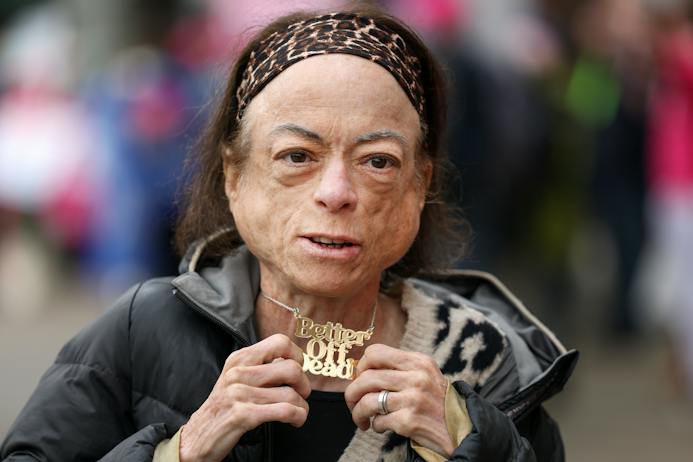 Liz Carr protests the assisted dying bill outside the Scottish parliament. (Jeff J Mitchell/Getty Images)
