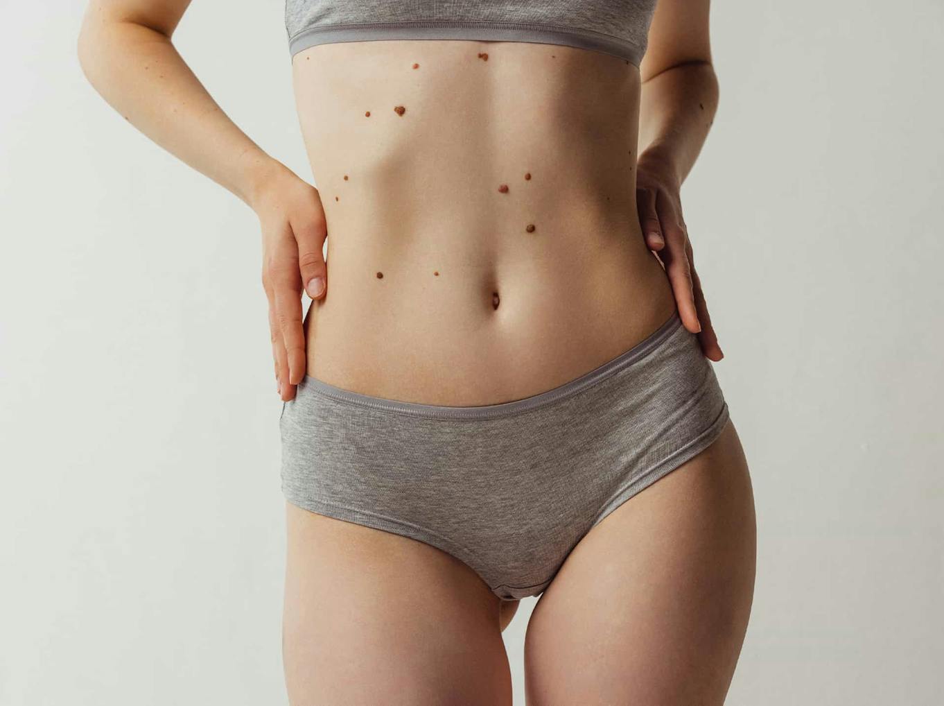 Woman in grey underwear with freckles