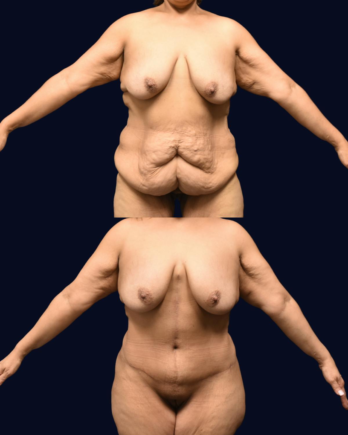 Fleur de Lis Before & After Gallery - Patient 610079 - Image 1