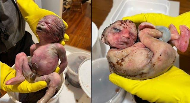 Photos by Mark Story. Babies Christopher X and Harriett were found in a medical waste bin outside of a D.C. abortion business. Pro-life activists wearing yellow gloves hold two aborted babies who appear near full term and were found in medical waste bin outside of Washington Surgi-Clinic..