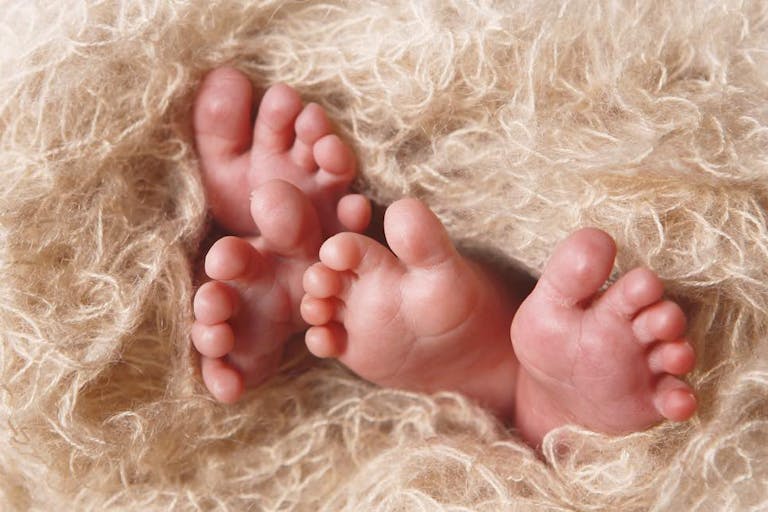 twins, conjoined twins, abortion, preamture, babies, embryos