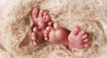twins, conjoined twins, abortion, preamture, babies, embryos