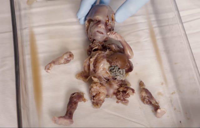 Illinois abortionist wants woman suing him for botched abortion to be named publicly image