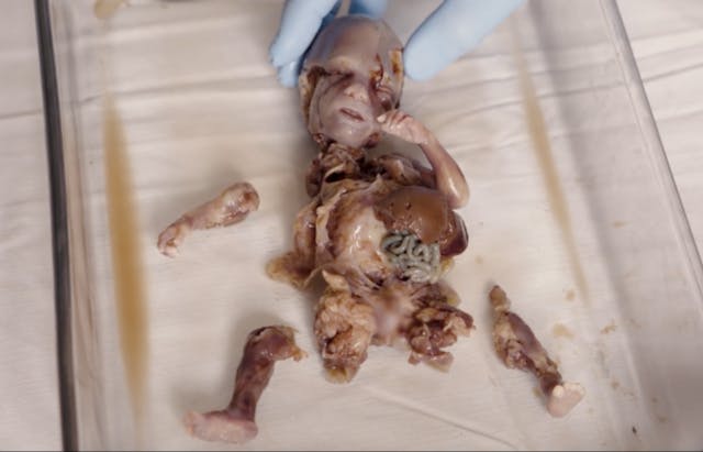 Baby Angel was found in a medical waste bin. Experts believe he was possibly exsanguinated and dismembered alive. Illinois abortionist wants woman suing him for botched abortion to be named publicly image