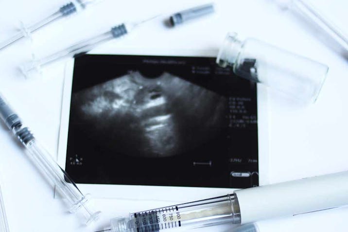 reproductive technology, IVF, fertility treatments, donor