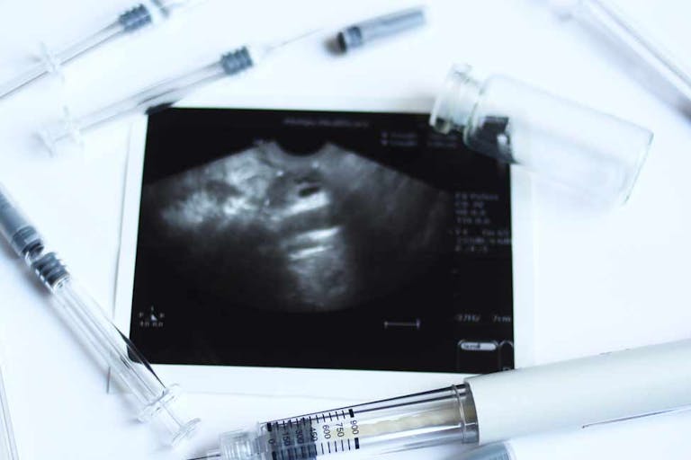 reproductive technology, IVF, fertility treatments, donor