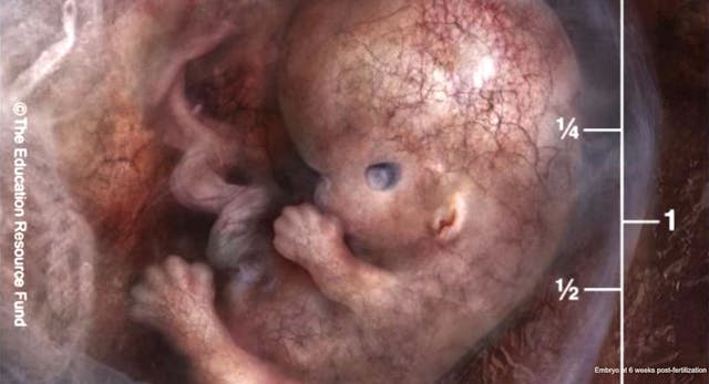 Embryo 6 week post-fertilization (8 weeks gestation) heartbeat