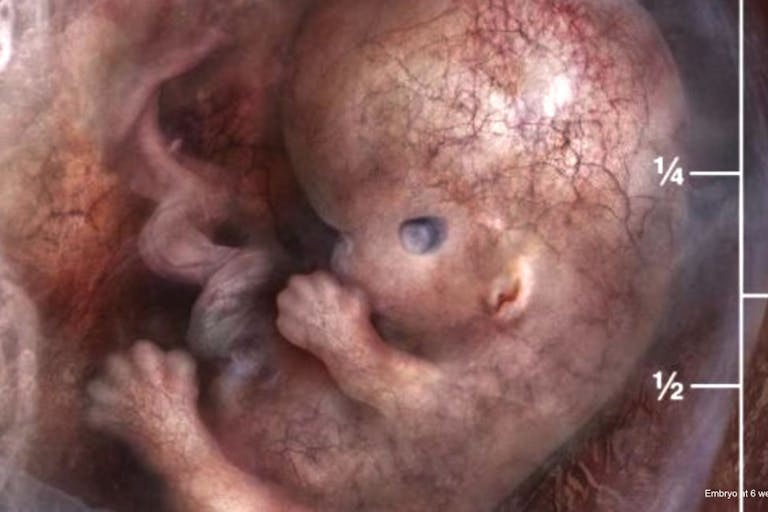 Embryo 6 week post-fertilization (8 weeks gestation) heartbeat