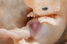 first trimester, Planned Parenthood, Warren Hern