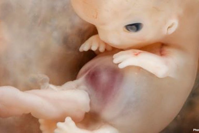 first trimester, Planned Parenthood, Warren Hern