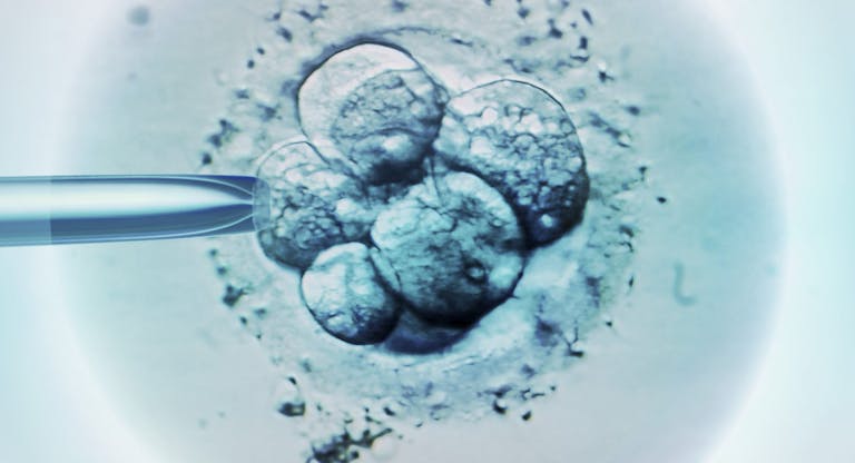 IVF, embryo, embryos