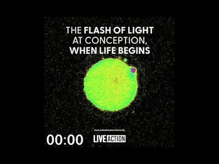 The flash of light when a child's life starts! thumbnail