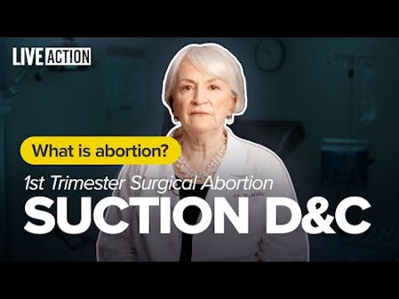 1st Trimester Abortion | Suction Dilation and Curettage (D&C) | What is Abortion? thumbnail
