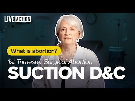 1st Trimester Abortion | Suction Dilation and Curettage (D&C) | What is Abortion? thumbnail