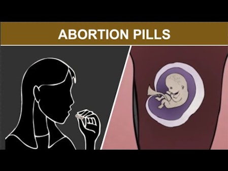 1st Trimester Medical Abortion: Abortion Pills thumbnail