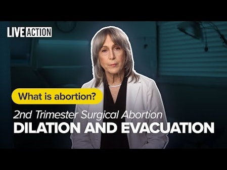 2nd Trimester Abortion | Dilation and Evacuation (D&E) | What Is Abortion? thumbnail