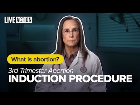 3rd Trimester Late-Term Abortion | Induction Abortion | What Is Abortion? thumbnail