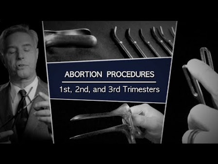 Abortion Procedures: 1st, 2nd, and 3rd Trimesters thumbnail