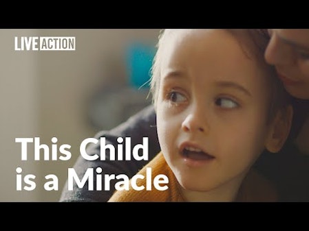 Child with rare disability teaches us about love and humanity thumbnail