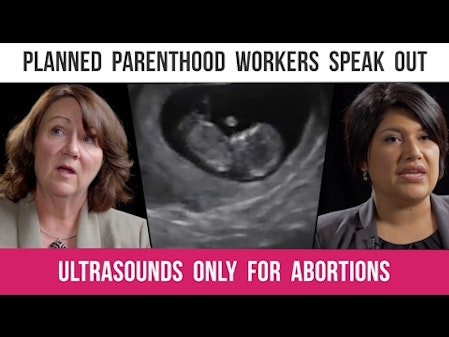 Planned Parenthood Managers: Ultrasounds for Abortions, Not Health Care thumbnail
