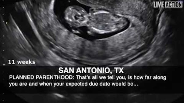 Ultrasounds for Killing, Not Care, at Planned Parenthood thumbnail