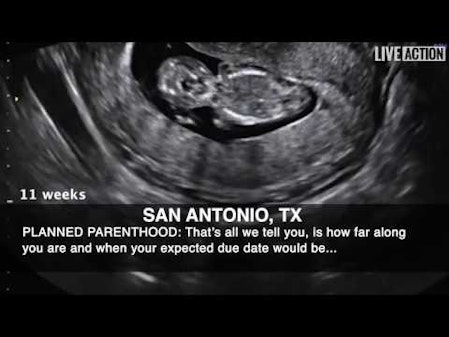 Ultrasounds for Killing, Not Care, at Planned Parenthood thumbnail