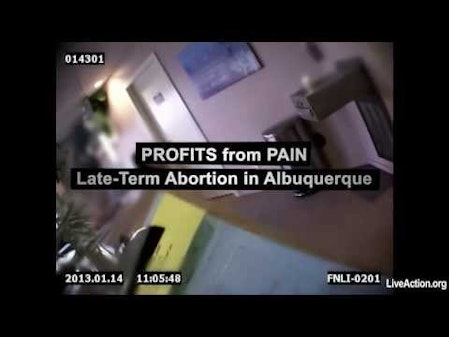 Profits from Pain: Late-Term Abortion in ABQ thumbnail