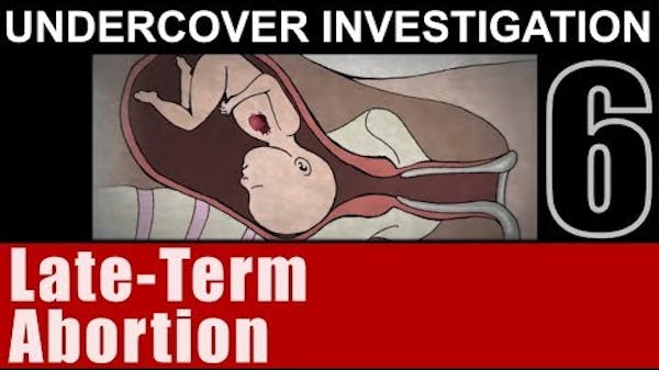 What is Human? thumbnail