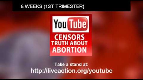 Planned Parenthood Lies About Abortion Images (censored by YouTube) thumbnail
