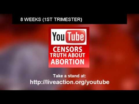 Planned Parenthood Lies About Abortion Images (censored by YouTube) thumbnail