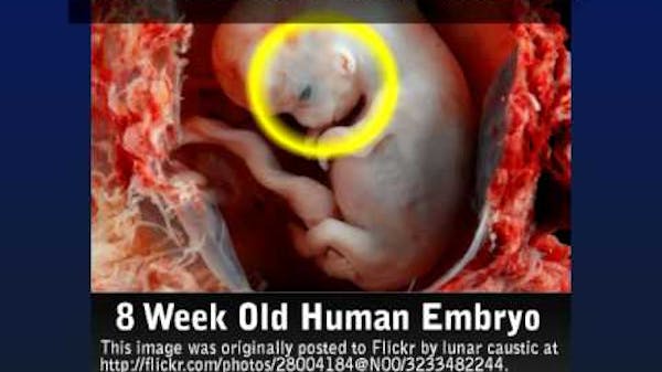 Live Action Responds to Memphis Planned Parenthood Letter thumbnail