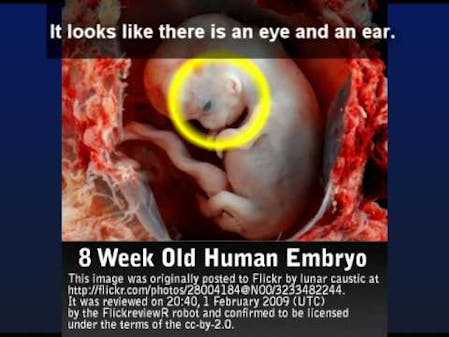 Live Action Responds to Memphis Planned Parenthood Letter thumbnail