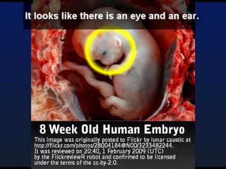Live Action Responds to Memphis Planned Parenthood Letter thumbnail