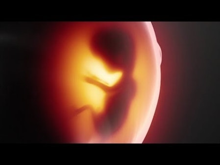 Child's development from fertilization to birth thumbnail