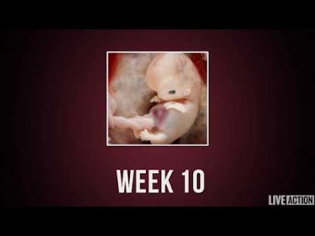 Baby Development Week by Week thumbnail