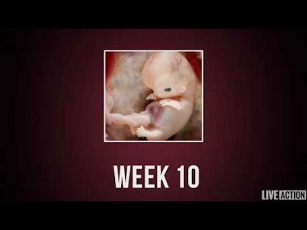 Baby Development Week by Week thumbnail