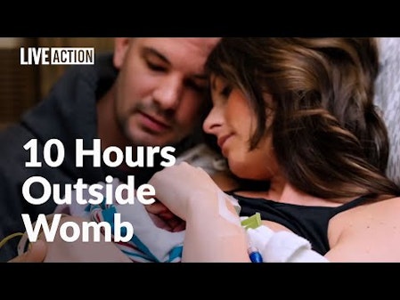 Parents love and care for daughter with anencephaly - "Our Blessing, Our Grace" thumbnail