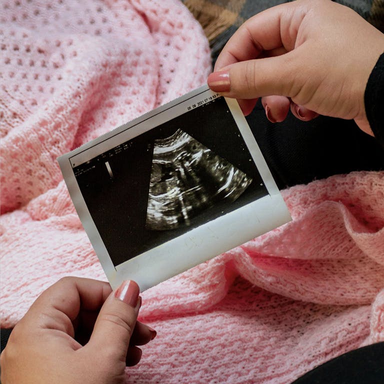 Sonogram photo being held by two hands on top of a pink blanket