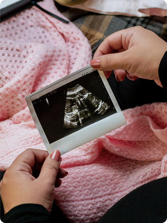 Sonogram photo being held by two hands on top of a pink blanket