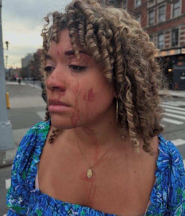 Pro-Life Journalist Assaulted by Pro-Abortion Attacker While Conducting Interviews in New York City image