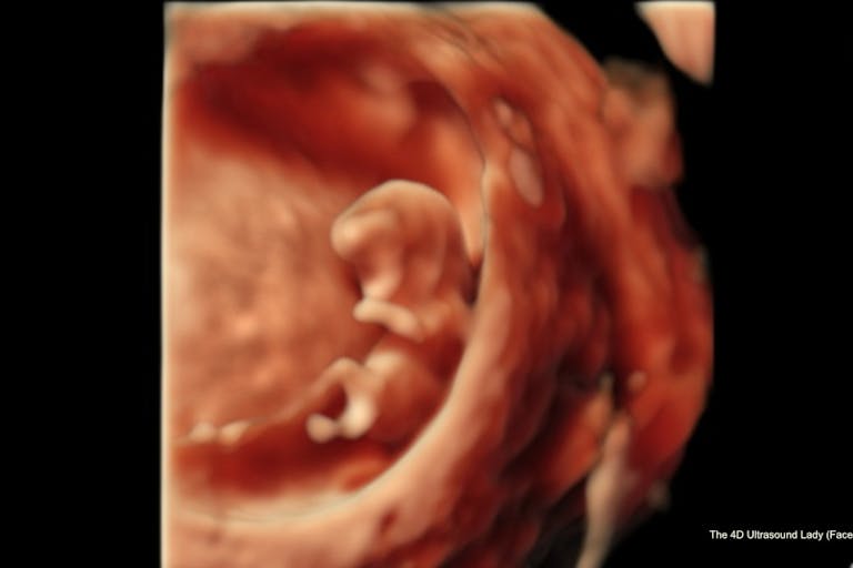 9 weeks 5 days (4-D Ultrasound Lady)