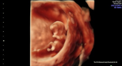9 weeks 5 days (4-D Ultrasound Lady)