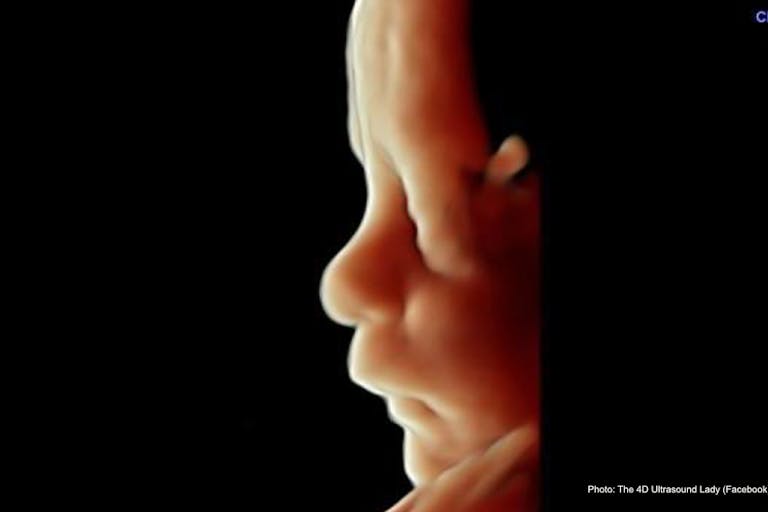 27 wks gestation profile – 4D Ultrasound Lady