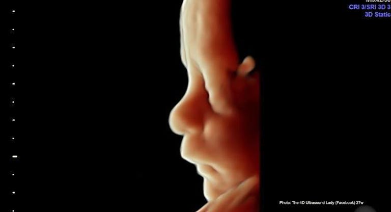 27 wks gestation profile – 4D Ultrasound Lady