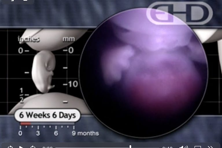 EHD 6 weeks 6 days after fertilization