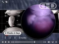 EHD 6 weeks 6 days after fertilization
