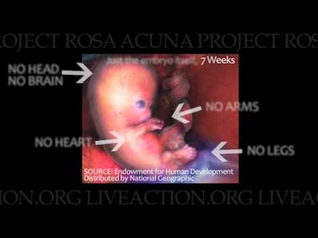 Planned Parenthood deceptive, manipulative abortion SALES PITCH thumbnail