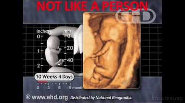 Indiana Planned Parenthood Caught On Tape Giving Fabricated Medical Information thumbnail