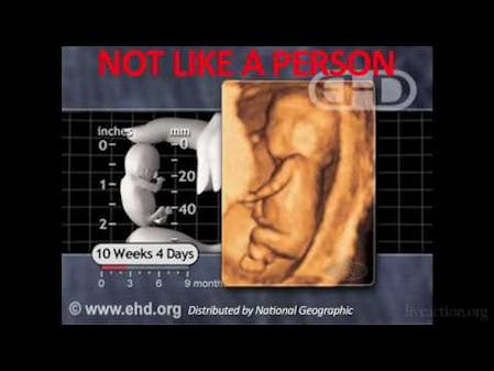 Indiana Planned Parenthood Caught On Tape Giving Fabricated Medical Information thumbnail